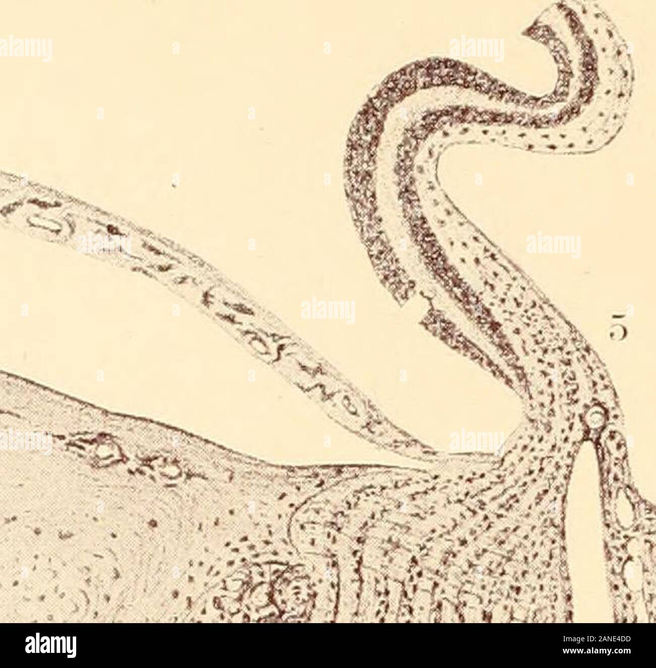 Die giftigen amblyopias ihre Einstufung, Geschichte, Symptome