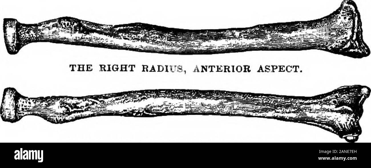 Eine bebilderte Medizinische encyclopaedic dictionaryBeing ein Wörterbuch  der technischen Begriffe von Schriftstellern auf die Medizin und die  Sicherheiten, in der Latein, Englisch, Französisch und Deutsch. ; S).  Fi-om-Radius (g. V.), prce, vor,