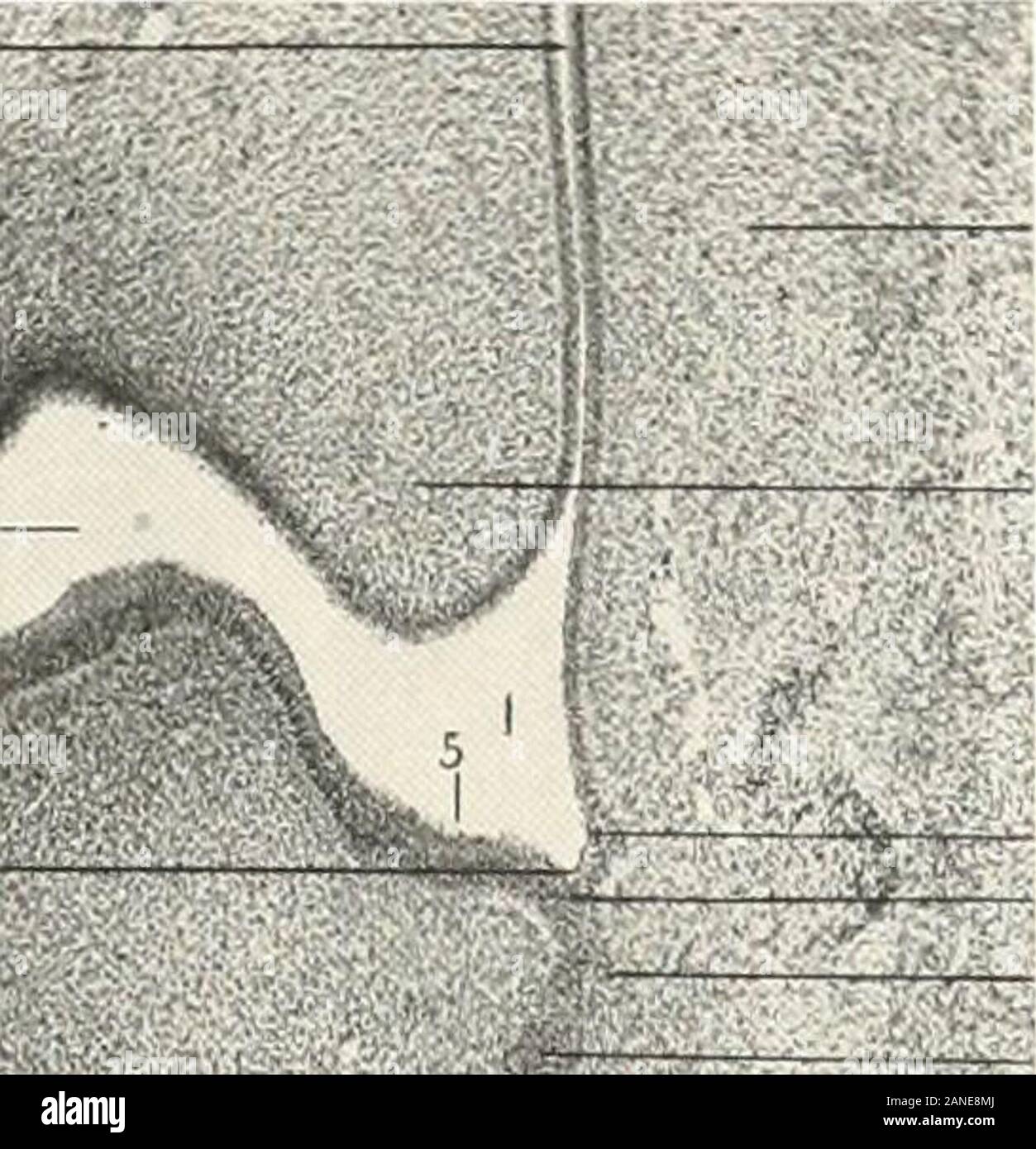 Beiträge zur Anatomie und Entwicklung der Speicheldrüsen in der MAMMALIA. 18. 10 19 18 14 Abb. 6. IlG. S, INDEX Zubehör Ohrspeicheldrüse, 74; in Cynoceplialusiiamadryas. 85 Zubehör submaxillani Drüse oder Drüsen, 75, 90,91, 95-96. 104. Nein, lOO adenoiden Follikel. Peritonsillar, 22 Alveobuccal und alveolabial Sulci in Mann, 6; in der Katze, 160-62. 239-42, 308 Alveobuccal oder molare Drüsen. Die minderwertigen, incarnivora, 157-58, 188; der Katze, 166, 209-10. 274, 299, 300-1; der Löwin. 169; von thedog, 171; der Thibetan tragen, 172; Der thebadger. 175; der Vielfraß, 176-77; der Löwe. 180 Alveobu Stockfoto