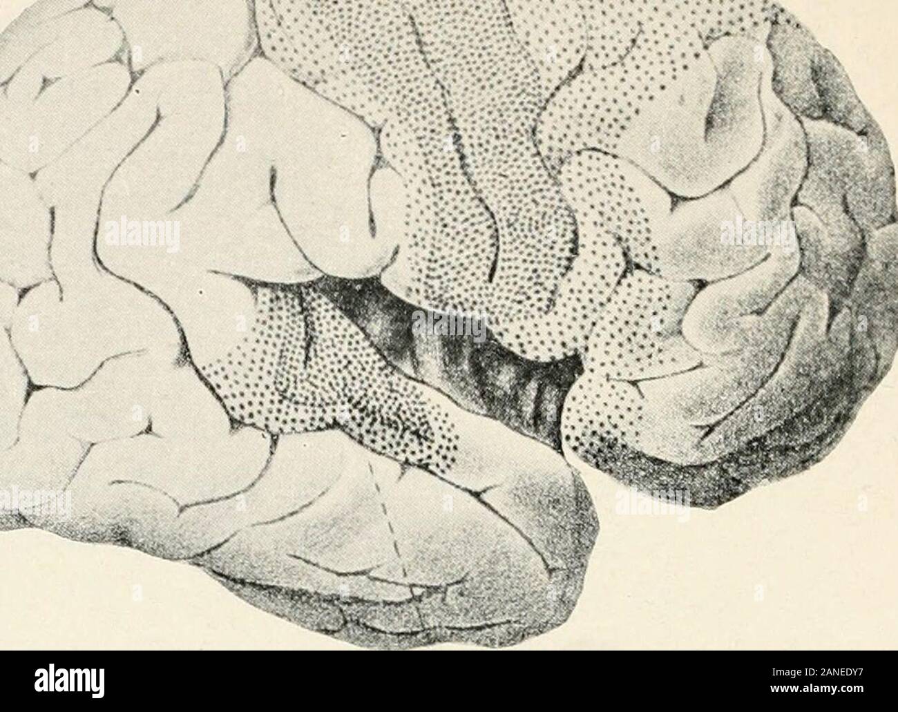 Experimentelle Psychologie und das Lager auf die Kultur. Terial wenden. Also taten auch Männer, in ihre Theorie, bewachen den Geist von Verunreinigungen. Seltsam zu sagen, war es Galle und die phrenologistswho lenkte die Aufmerksamkeit weg von diesen neugierig Spekula- tionen und betonte die physiologische Bedeutung der Hirnwindungen, - die äußere Oberfläche der Hemi-Sphären, - Lehre gleichzeitig, dass differentportions der Oberfläche wurden differentspiritual Funktionen gegeben: sammelwut, Kampfbereitschaft, Rev-Verweis, und dergleichen. Diese Vorstellung, dass die nervouscounterparts der verschiedenen psychischen Funktionen ares Stockfoto