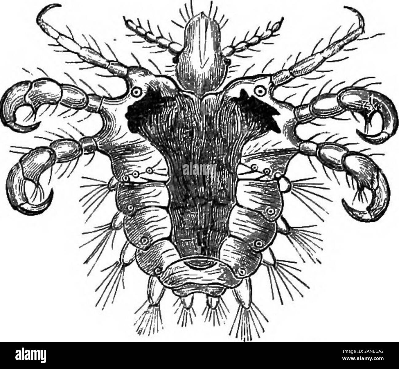 Eine bebilderte Medizinische encyclopaedic dictionaryBeing ein Wörterbuch der technischen Begriffe von Schriftstellern auf die Medizin und die Sicherheiten, die in der Lateinischen, Englischen, Französischen und Deutschen Sprachen. se). ¥ r., phthiriase, ntaladie p&diculaire. Ger., S., Ldusesucht, Ldusekrankheit. Ijousiness, mieser Staupe; eine Krankheit, in der pediculi multiplyon die Haut oder die Haare. Die irrige Meinung früher prevailedthat pediculi spontan bei der kutanen Geschwüre orabscesses generiert wurden, bilden eine Art Diathese, und vor kurzem von thatnumbers pediculi von der Oberfläche in die Langeweile Stockfoto