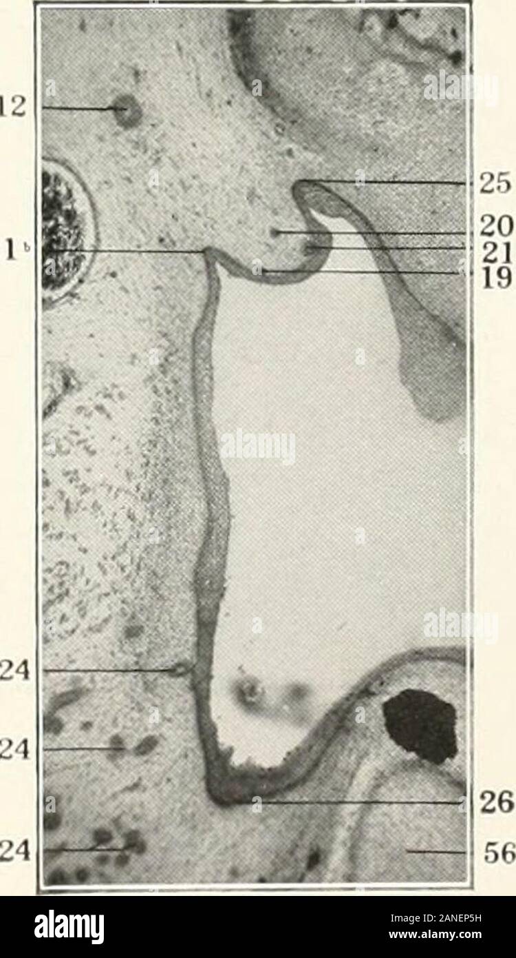 Beiträge zur Anatomie und Entwicklung der Speicheldrüsen in der MAMMALIA. Abb. 115. Abb. 116. Platte LXX Feigen. 118-121. Teile der alveolingual Region eines 11 Millimeter embr&gt; o. Columbia Sammlung, Nr. 213. Jeder dritte Abschnitt. Dicke ofsections 13.3/i auf. X 115 reduziert habe. 2 Q. Mehrsprachiges Sulcus. JO. Submaxillary Anlage. 40. Seitliche Zunge anschwellen. 41. Tuberculum impar. 4 j. Palatolingual Ebene. 44. Alveolingual Region. 45. Palalomandibular Ebene. 46. Maxillomandibular Ebene. 47. Nucleus nervus hypoglossus Nerv. 48. Mehrsprachiges Nerv. 4 Jahre. Submaxillary Ganglienzellen. 55. Meckels Knorpel. 65. Inf Stockfoto