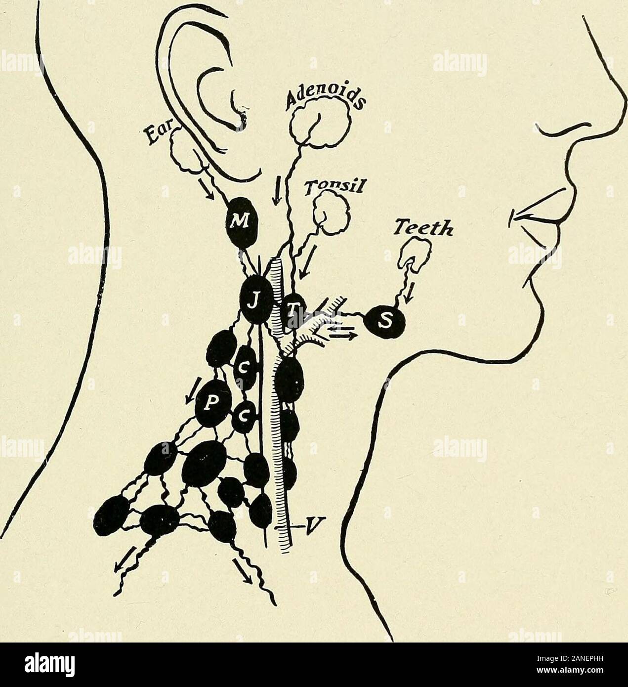 Cervical lymph nodes Fotos und Bildmaterial in hoher Auflösung Alamy