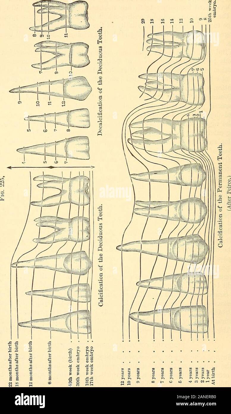 Grundsätze und Praxis der Operative Zahnheilkunde. e Seiner Schöpfung, sondern die schrittweise erfolgen astronger und dauerhaftere Gegenstück von sich geben. Pathologie, wir aretaught zu glauben, ist Pervertiert Physiologie; aber gerade wo Normal- funktion aufhört und krankhaften Bedingungen beginnen die Wissenschaft hat noch nicht können, demonstrieren. Das zugehörige Diagramm (Abb. 225, Seite 78), drawnby Professor C.N. Peirce, die meisten bewundernswert verdeutlicht die Zeiträume bei whichcalcification Platz in der Laub- und der bleibenden Zähne, andalso die Entkalkung oder Resorption der Wurzeln der Laubbäume Stockfoto