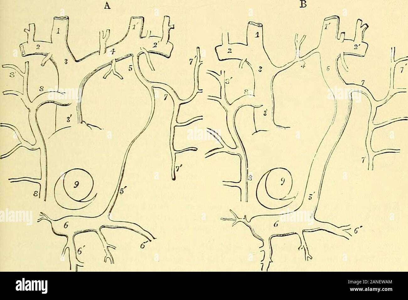 Venas iliacas externas Fotos und Bildmaterial in hoher Auflösung Alamy
