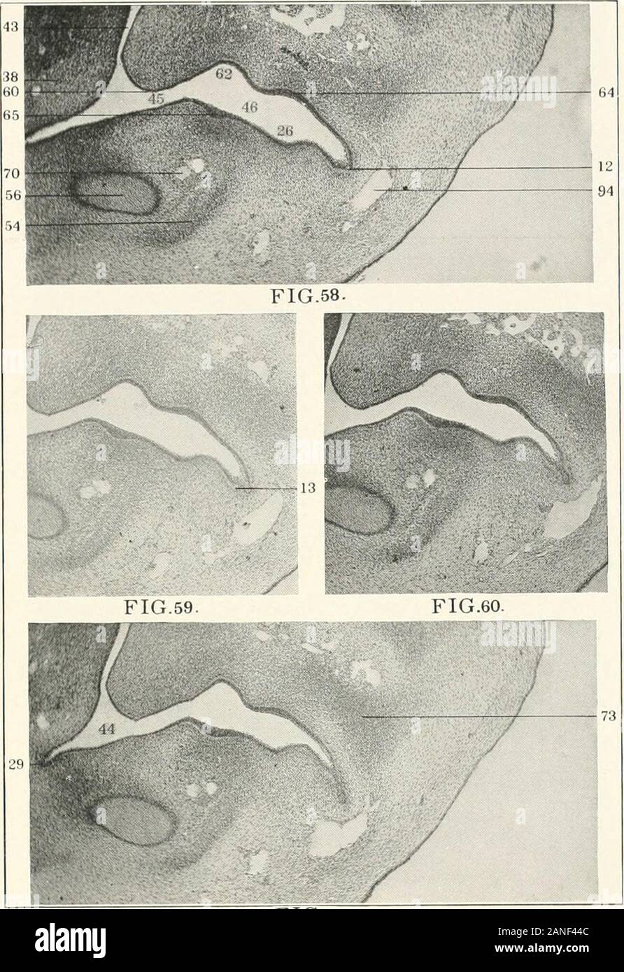Beiträge zur Anatomie und Entwicklung der Speicheldrüsen in der MAMMALIA. Abb. 52 Abb. 57 Platte LX-Abbn. 58-61. Mit der rechten Ohrspeicheldrüse Anlage von 13,5 Millimeter embro. Columbia COL-lection, Nr. 223. Serie von wechseln sich Abschnitte, X115, auf 5 reduziert. 12. Ohrspeicheldrüse Anlage. Ich, Subparotid Kondensation von mesenchym. 26. Minderwertige alveobuccal Sulcus. 2 g. Mehrsprachiges Sulcus. 38. Zunge. 43. Palatolingual Ebene. 44. . Lveolingual Region. 45. Palatoma. xillary Ebene. 46. Mandibulomaxillary Ebene. 54 - minderwertige Oberkiefer. 5 (5. Meckels Knorpel. 60. Prozess Gaumen. 62. Ectopalatine Sulcus. 64. Superior denta Stockfoto