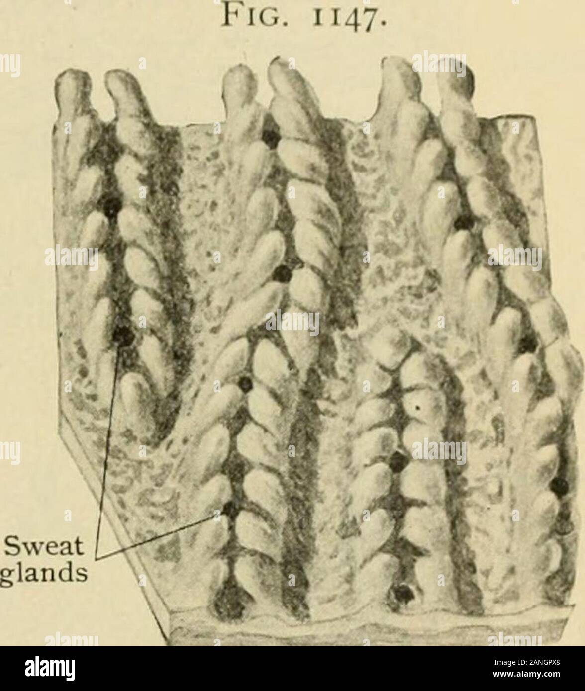 Der menschlichen Anatomie, einschließlich der Struktur und Entwicklung und praktischen Erwägungen. Wu Teil der Lederhaut aus palmarsurface von Hand nach Ausbau der Epi-lederhaut; jeder Bereich eine inchides doublerow von papillse, die imderlie thesuperficial kutane Bergrücken und en-enge Öffnungen von Schweißdrüsen; latterappear als dunkle Punkte entlang rangesof papillfe. X5.. Kleine Portion] ireceilini, Muster, papille angezeigt; bei höherer Magnifica-; Drosselbohrungen zerrissenen Schweißdrüsen papillse seenbetween sind. X 24 Krawatten und mit kleinen, unregelmäßigen Gitter auf das Gesicht (blaschko). Die besten developedpapillae sind auf der fle Stockfoto