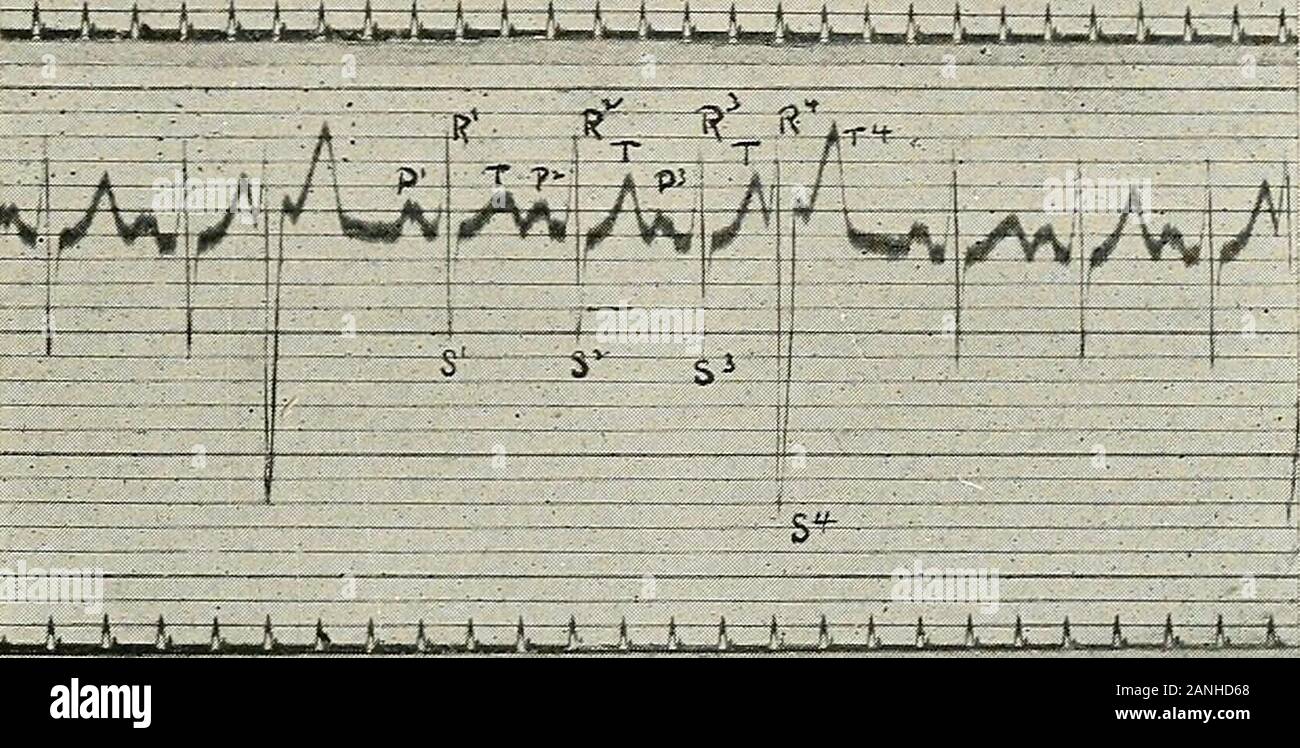 Erkrankungen der Brust und der Prinzipien der physischen Diagnose. SfnC Stockfoto