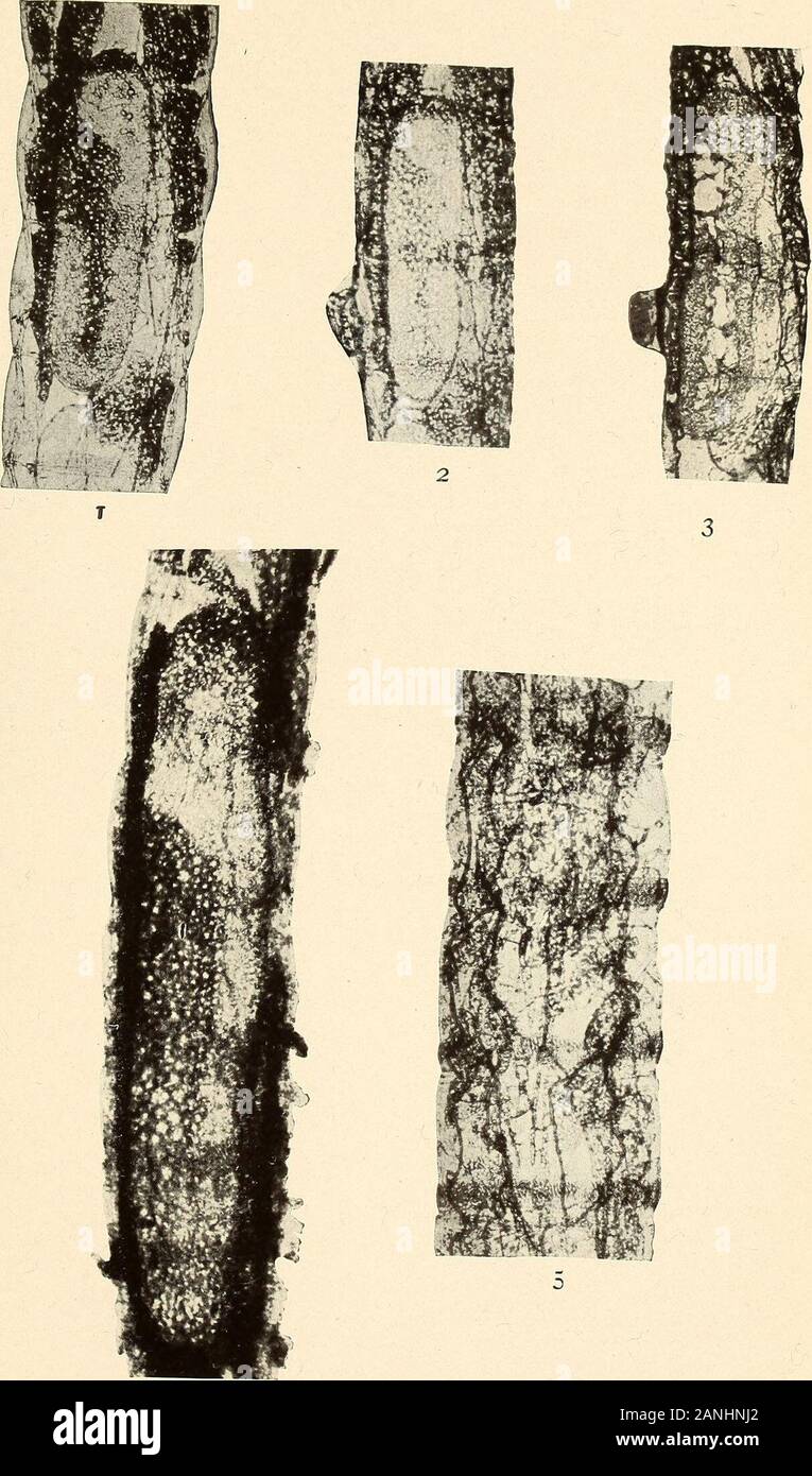 Jahresbericht. Miastor Embryonen Platte 32 l 67 Miastor? Americana Filz 1 lebenden Embryo innerhalb eines kleinen, gelblichen Larven. Beachten Sie die unterschiedlichen germinalstreak mit seinem breiten Projektion auf der einen Seite in der Nähe des vorderen Drittel, und thecephalic Cap von Fuscous Zellen, x ioo 2 Der Embryo 24 Stunden später fotografiert und zeigt einige ändern. Dieses Foto relativ war nicht so gut wie der erste, x 100 3 Die gleiche Embryo einige Tage später zeigt den Zustand nach disintegra-tion hat begonnen, x 100 4 eine größere Embryo in einem kleinen, gelb Mutter Larve, die sich von ihrem fifthto achte Körpersegmente. Hinweis Die gr Stockfoto