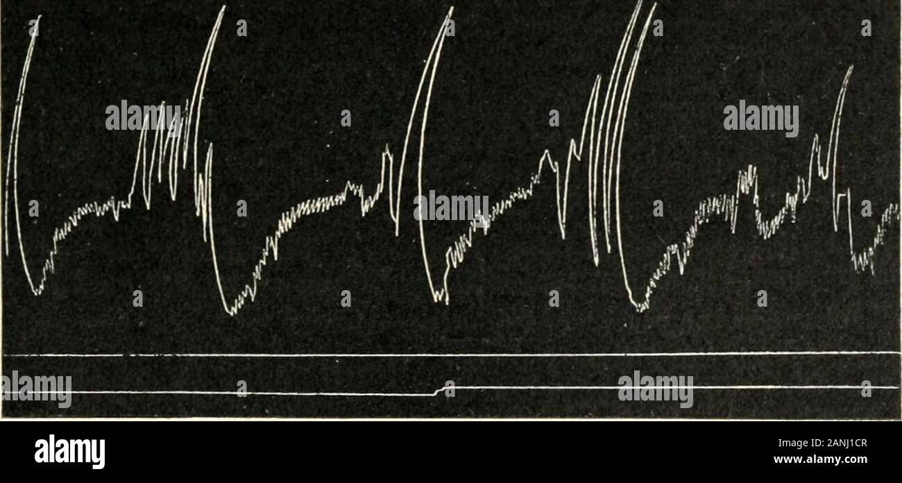 Die menschliche Physiologie. Abb. 70.-Tracing von rhythmisch und periodische Bewegungen in der pyloric Region gewonnen, der afterextirpation caeliac Plexus. (Ducceschi.) Aktion der spinalen Zentren, die gleichzeitig versuchen, Toinduce Erbrechen, coine ins Spiel. In jedem Fall ist es sicher, dass die Atemwege Zentren der Glühlampe sind recht verschieden von thevomiting Zentren. In der Tat, wenn die Bedingungen für die Erbrechen ausfallen. Fi<;;;;;;;. 71.- - Tracing der Periodischen Bewegungen in der Region, nach der Ausrottung ofcaeliac Plexus. (Ducceschi.) Aufgrund der zentralen Läsionen, eine übermäßige Tachypnoe beobachtet werden. Als auf den ot Stockfoto Die menschliche Physiologie. Abb. 70.-Tracing von rhythmisch und periodische Bewegungen in der pyloric Region gewonnen, der afterextirpation caeliac Plexus. (Ducceschi.) Aktion der spinalen Zentren, die gleichzeitig versuchen, Toinduce Erbrechen, coine ins Spiel. In jedem Fall ist es sicher, dass die Atemwege Zentren der Glühlampe sind recht verschieden von thevomiting Zentren. In der Tat, wenn die Bedingungen für die Erbrechen ausfallen. Fi<;;;;;;;. 71.- - Tracing der Periodischen Bewegungen in der Region, nach der Ausrottung ofcaeliac Plexus. (Ducceschi.) Aufgrund der zentralen Läsionen, eine übermäßige Tachypnoe beobachtet werden. Als auf den ot Stockfoto