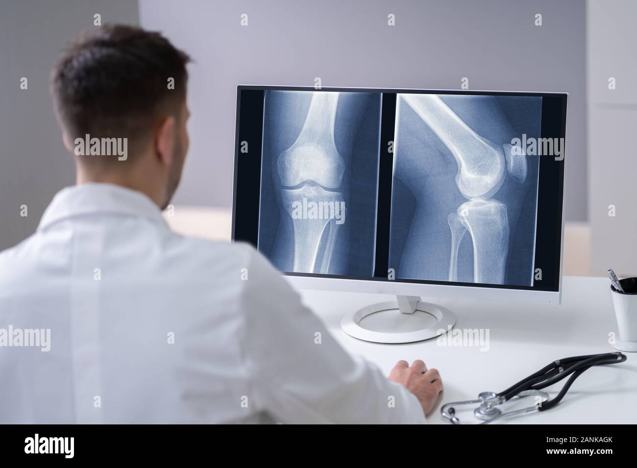 Reife männliche Arzt untersuchen Knie X-ray In der Klinik Stockfoto