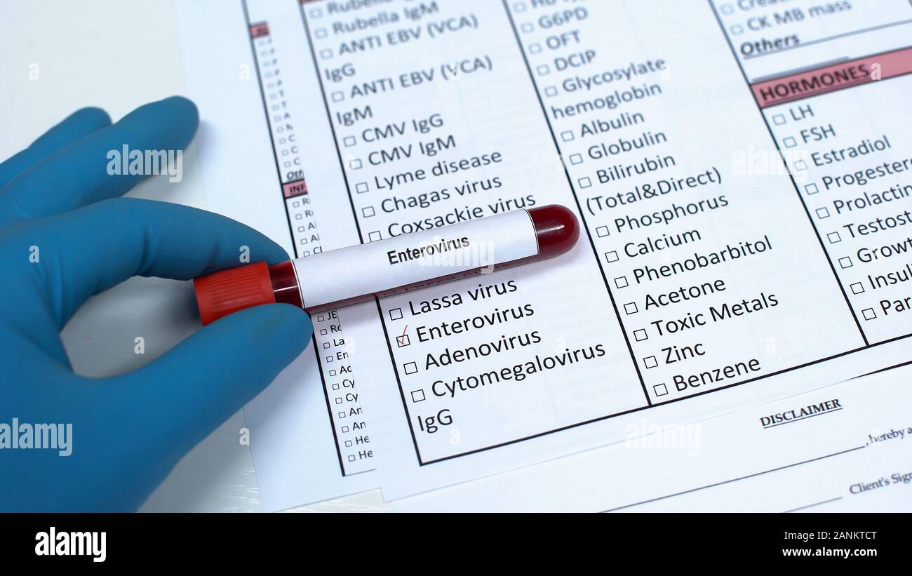Positive Enterovirus test, Arzt, Blut in der Tube, Gesundheit checkup Stockfoto