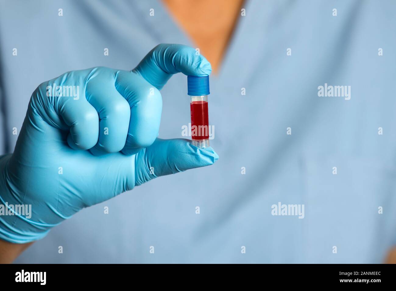 Medizintechnik hält kleine Blutprobe Rohr in Handschuhen. Stockfoto