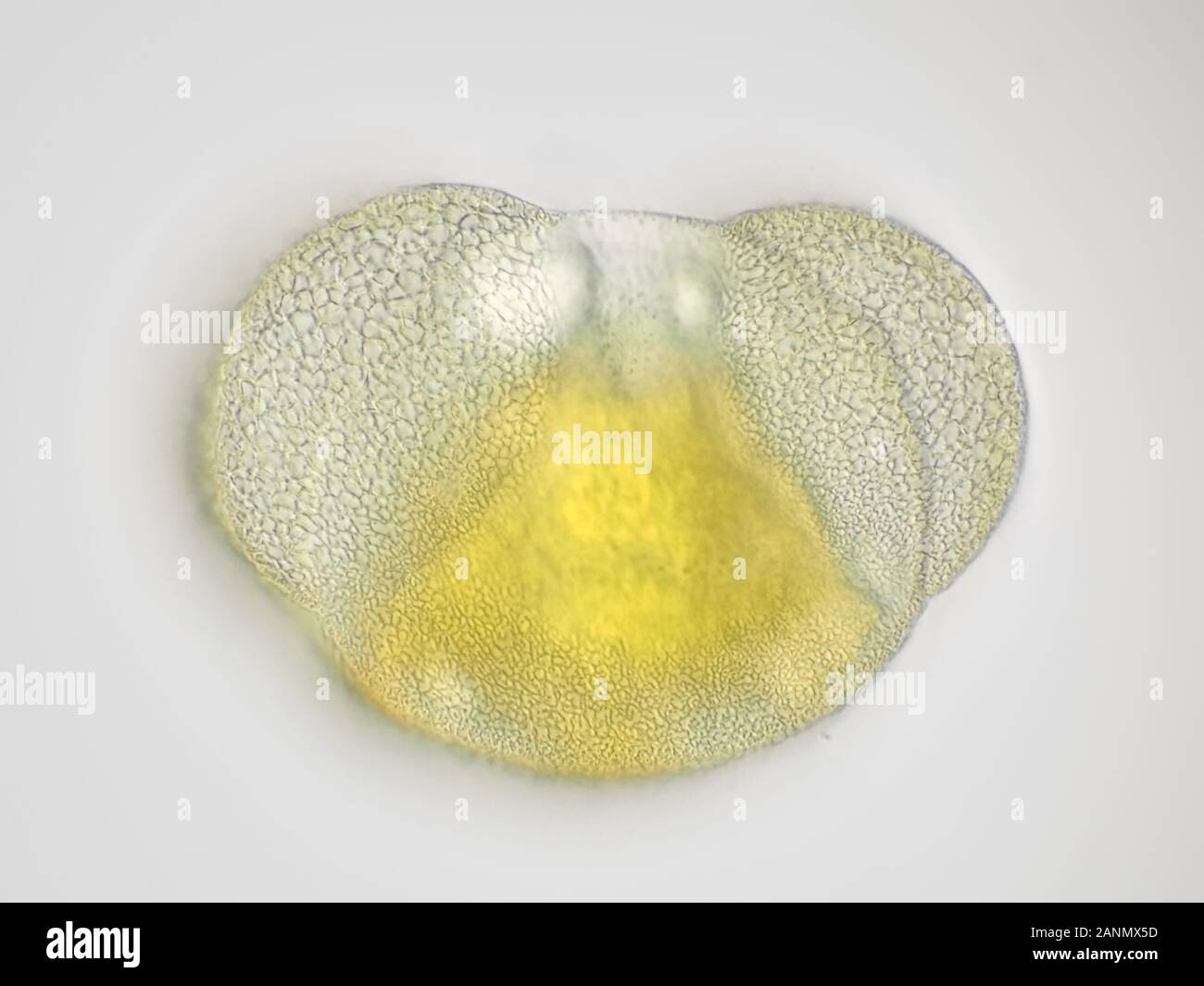 Nadelbaum-Pollen-Korn unter dem Mikroskop beträgt das horizontale Sichtfeld etwa 170 Mikrometer Stockfoto