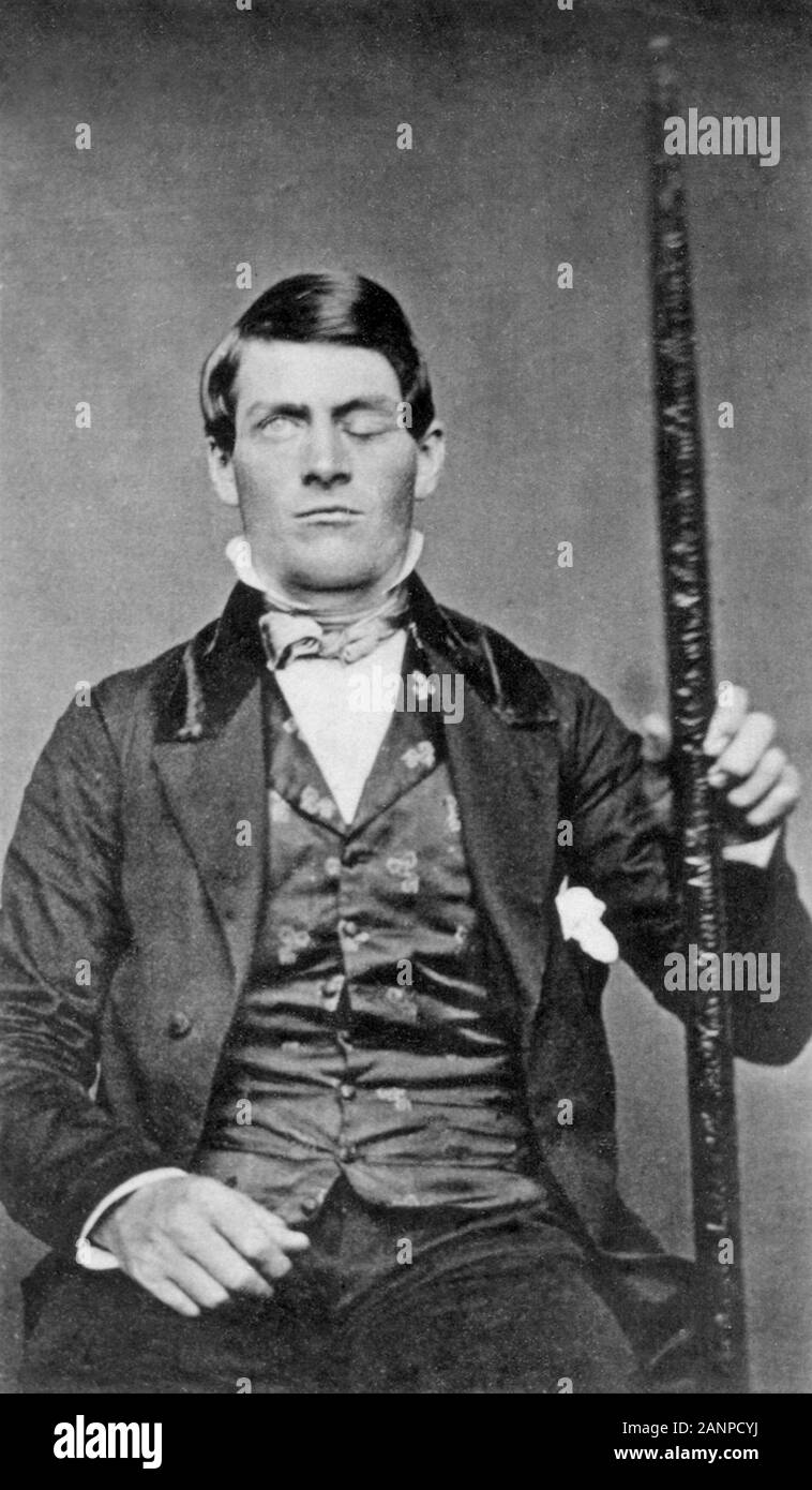 Phineas Gage, Phineas S. Gage (1823-1860), US-amerikanische Eisenbahn Bauleiter, die einen Unfall, bei dem eine große eiserne Stange vollständig durch den Kopf gefahren wurde, überlebte, zerstören viel der linke Frontallappen seines Gehirns Stockfoto