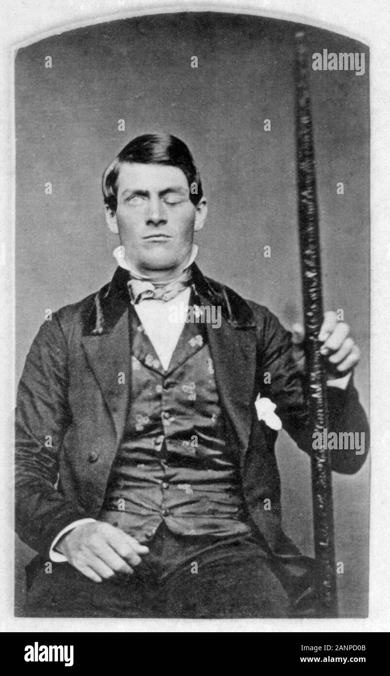 Phineas Gage, Phineas S. Gage (1823-1860), US-amerikanische Eisenbahn Bauleiter, die einen Unfall, bei dem eine große eiserne Stange vollständig durch den Kopf gefahren wurde, überlebte, zerstören viel der linke Frontallappen seines Gehirns Stockfoto