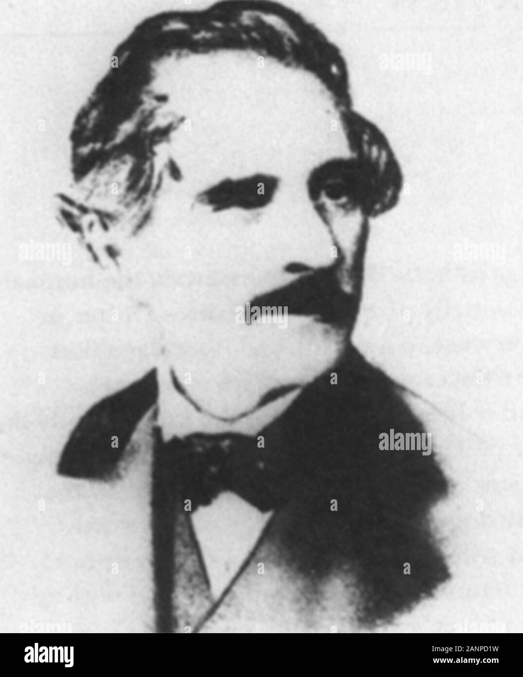 Charles T. Stent, Erfinder der Stent. Charles Stent (1807-1885) englischer Zahnarzt Stockfoto