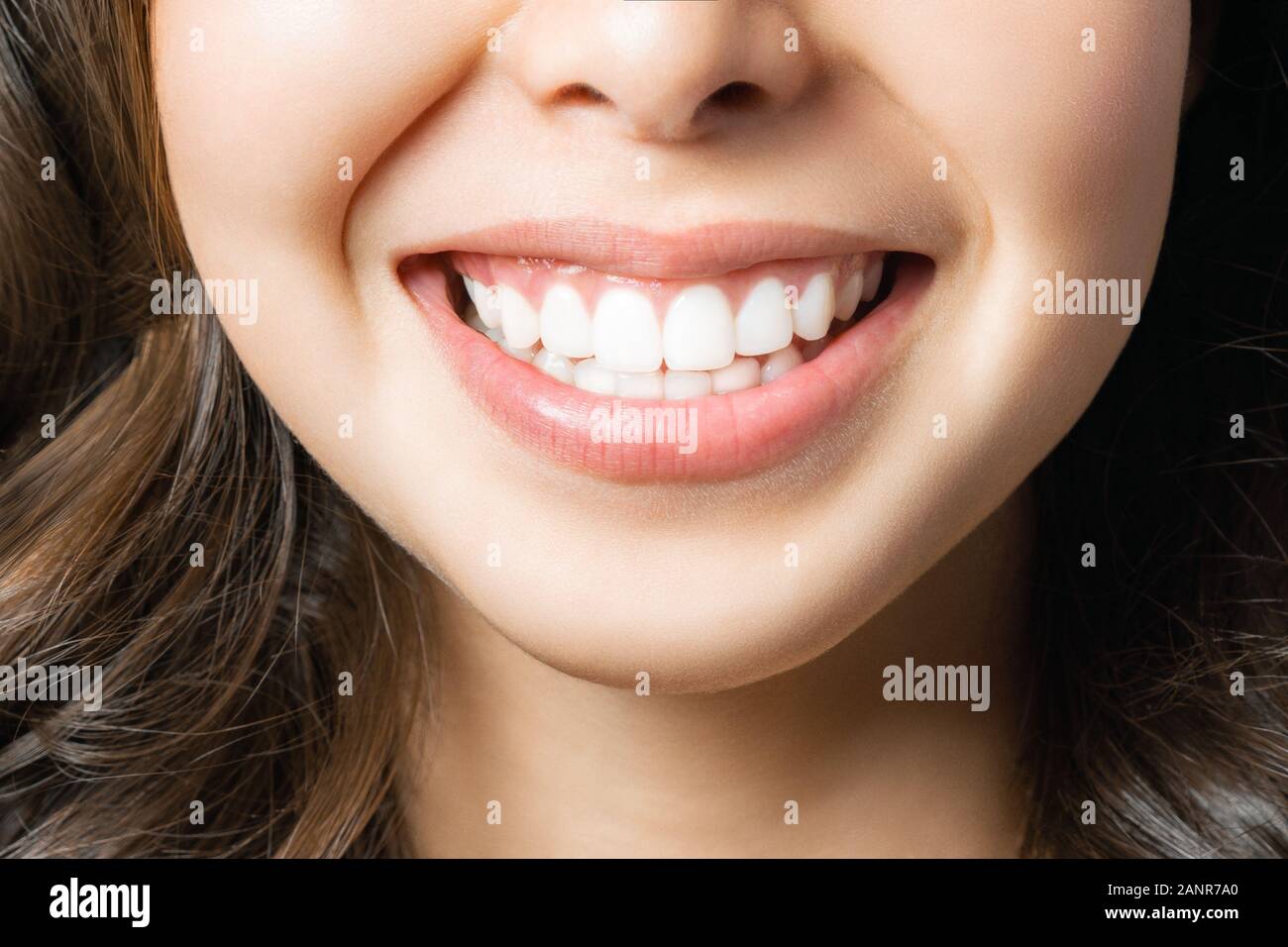 Perfekt gesunde Zähne Lächeln einer jungen Frau. Zähne, die. Zahnmedizinische Klinik Patienten. Bild symbolisiert Oral Care Zahnheilkunde, Zahnmedizin. Stockfoto