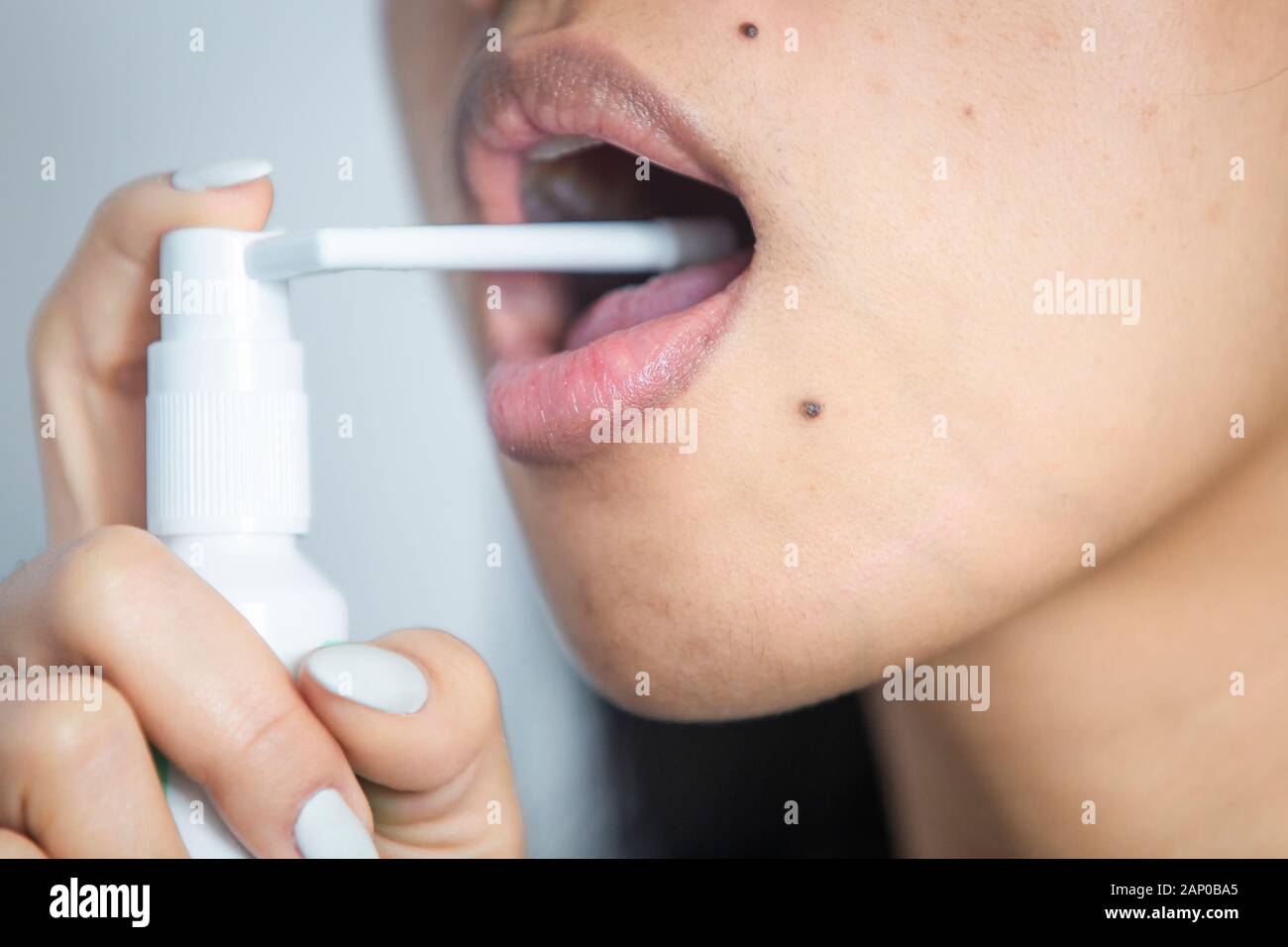 Frau, die ein Kehlspray mit Medikamenten verwendet, um Infektionen und Halsschmerzen zu reduzieren. Stockfoto