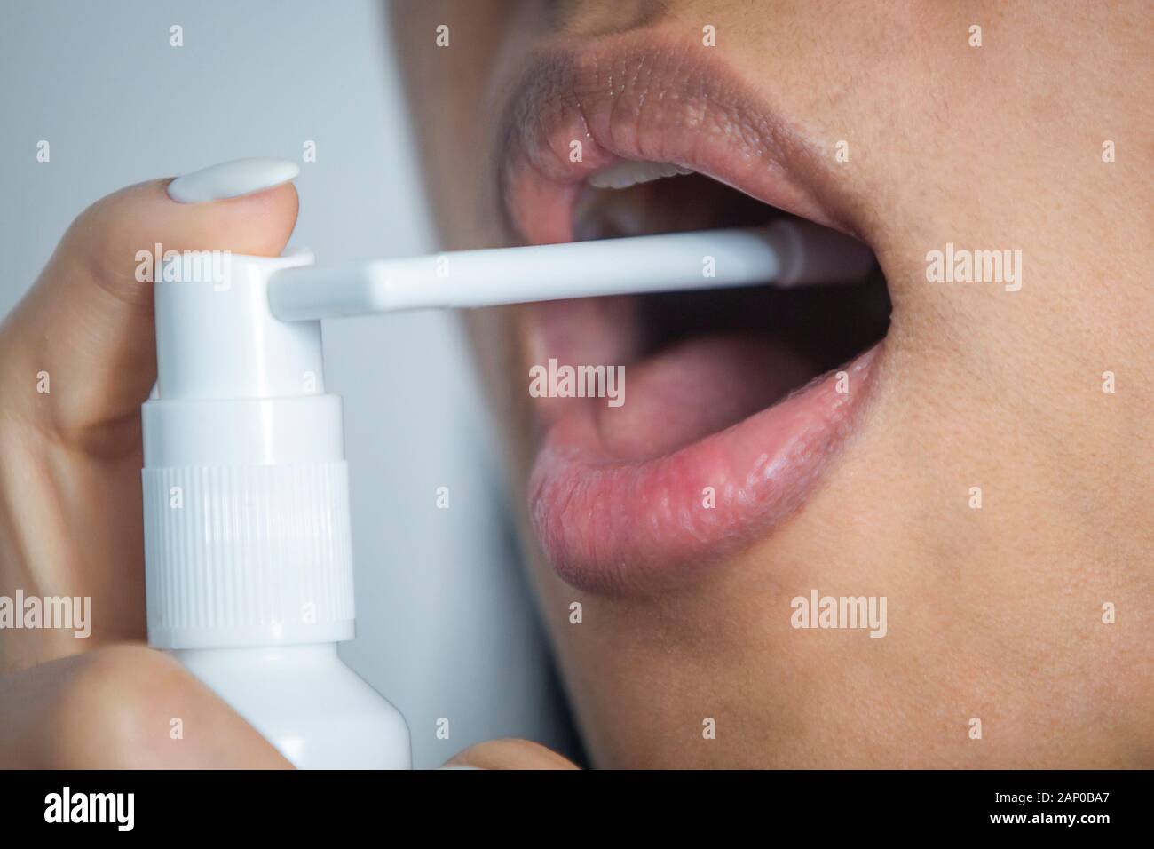 Frau, die ein Kehlspray mit Medikamenten verwendet, um Infektionen und Halsschmerzen zu reduzieren. Stockfoto