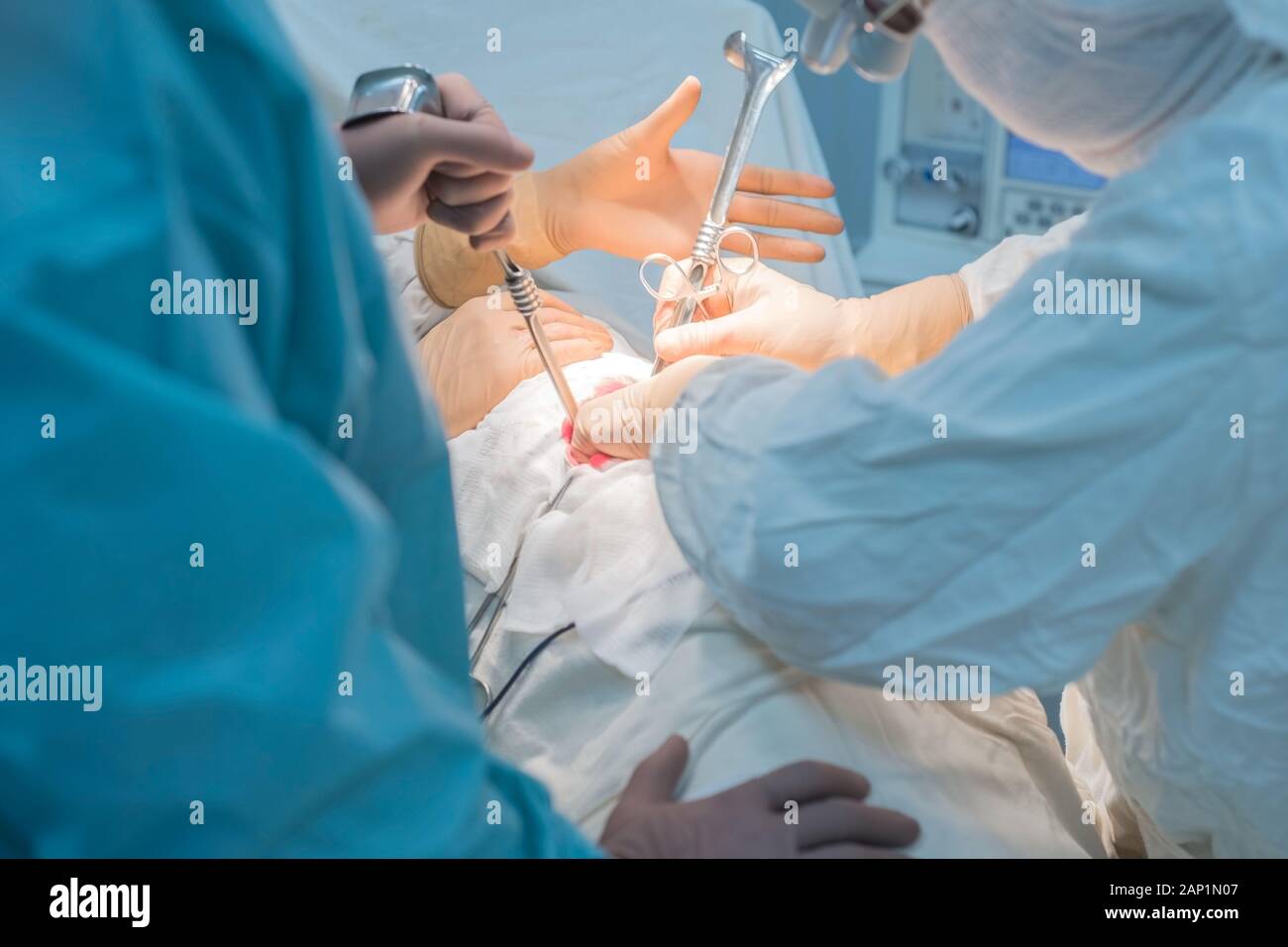 Ein Chirurg mit Assistenten, die in einem sterilen Operationssaal, ist auf die inneren Organe betrieben. Blau kalten OP-Leuchten. Die Hände des Chirurgen halten Sie die INSTRUME Stockfoto