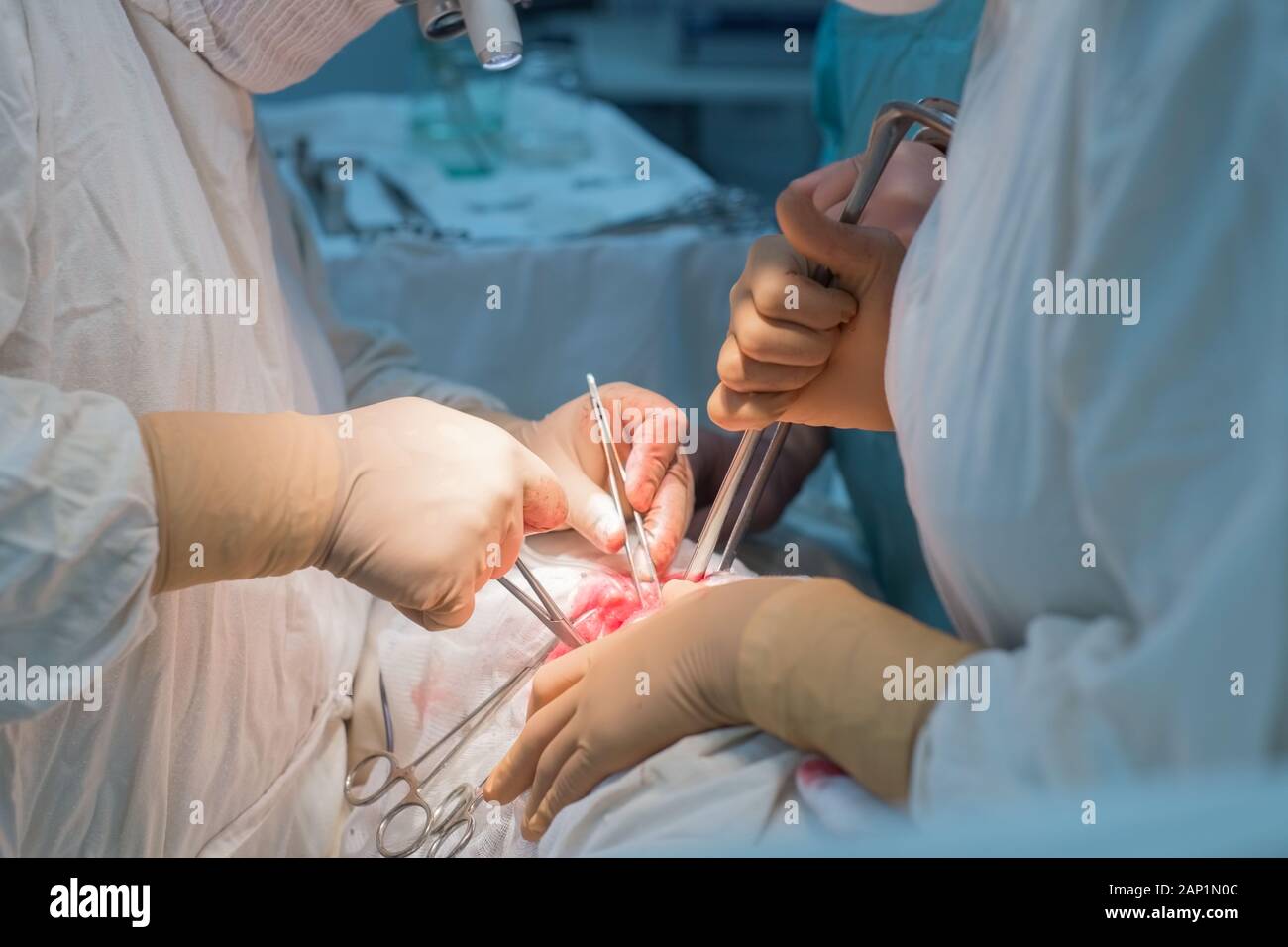 Team von Chirurgen während einer Operation. Sterile Op. Niere Chirurgie in einem kleinen Patienten. Chirurgische Verfahren Diagnose Stockfoto