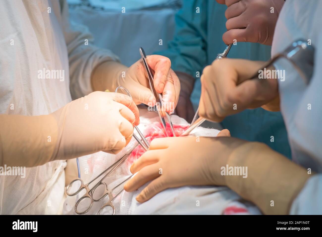 Team von Chirurgen während einer Operation. Sterile Op. Niere Chirurgie in einem kleinen Patienten. Chirurgische Verfahren Diagnose Stockfoto