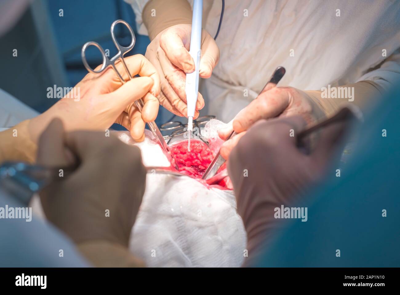 Ein Chirurg mit Assistenten, die in einem sterilen Operationssaal, ist auf die inneren Organe betrieben. Blau kalten OP-Leuchten. Die Hände des Chirurgen halten Sie die INSTRUME Stockfoto