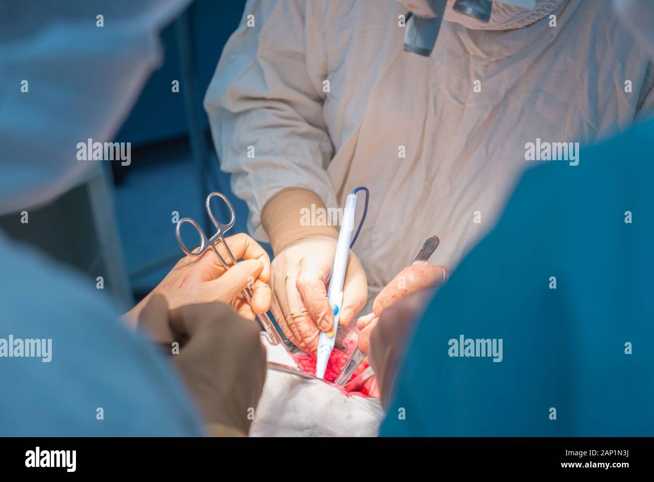 Ein Chirurg mit Assistenten, die in einem sterilen Operationssaal, ist auf die inneren Organe betrieben. Blau kalten OP-Leuchten. Die Hände des Chirurgen halten Sie die INSTRUME Stockfoto