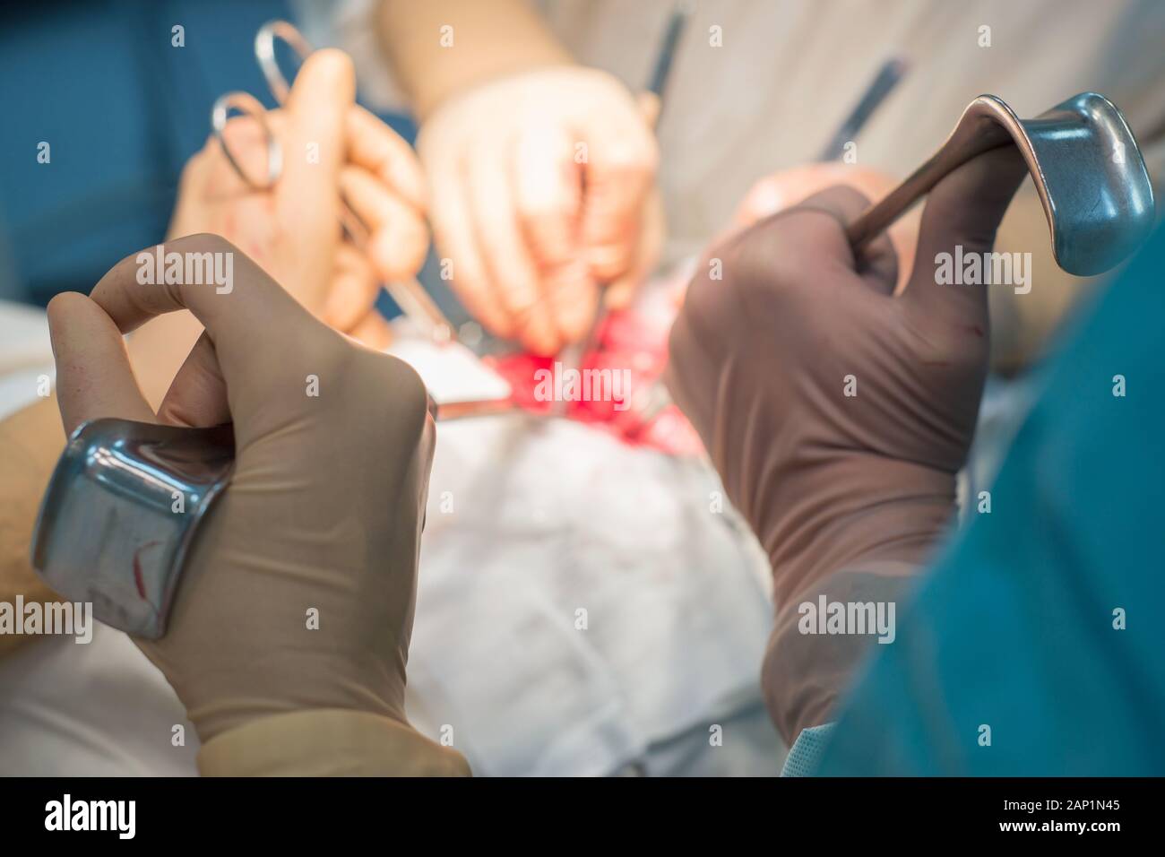 Ein Chirurg mit Assistenten, die in einem sterilen Operationssaal, ist auf die inneren Organe betrieben. Blau kalten OP-Leuchten. Die Hände des Chirurgen halten Sie die INSTRUME Stockfoto