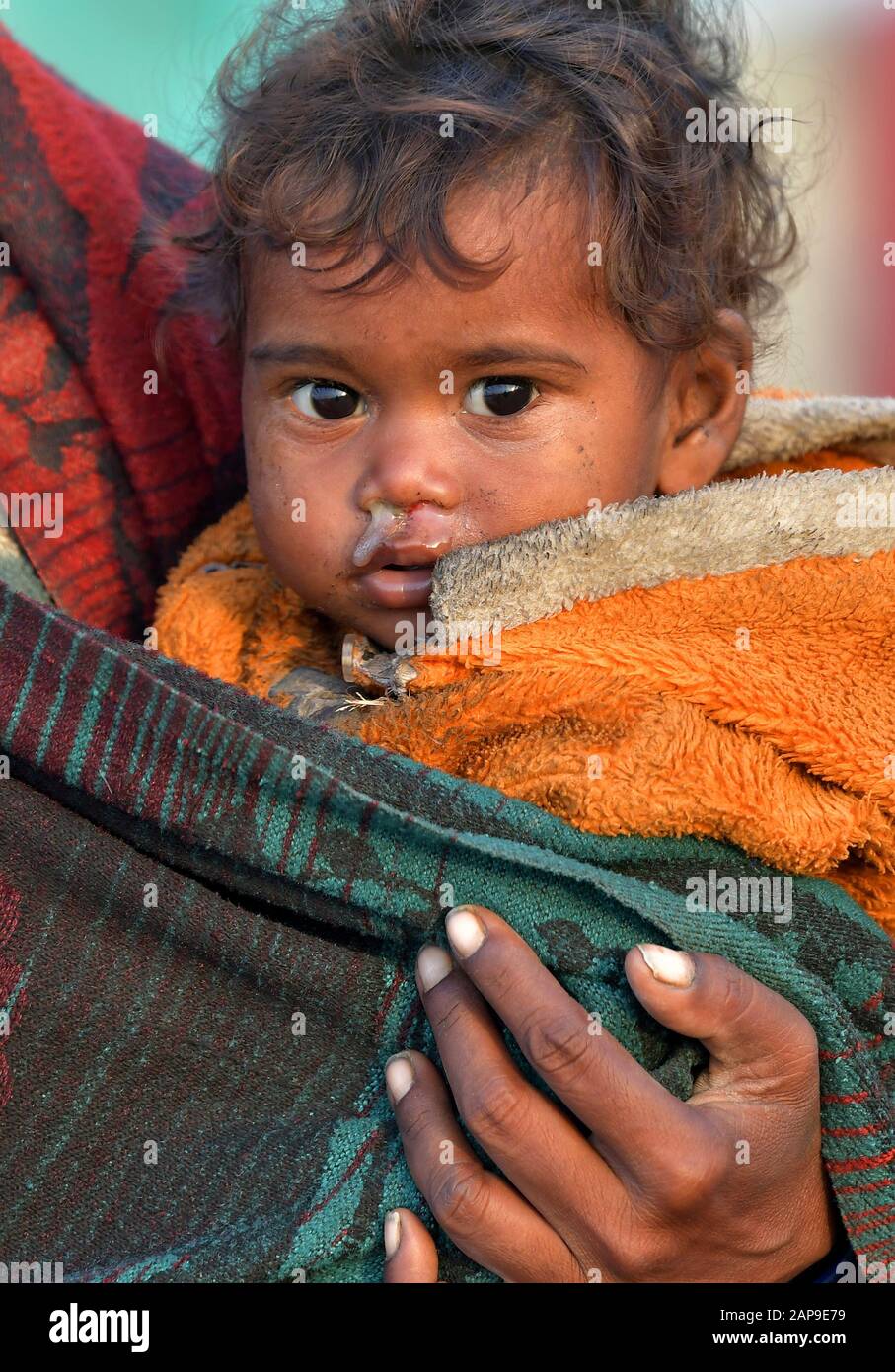 Nahaufnahme Schleim fließt aus der Nase, indisches Kind hat eine laufende Nase mit Gelbschnupfen.unhygienisch armen Jungen mit rotziger Nase und Kind hat eine Erkältung oder die Grippe Stockfoto