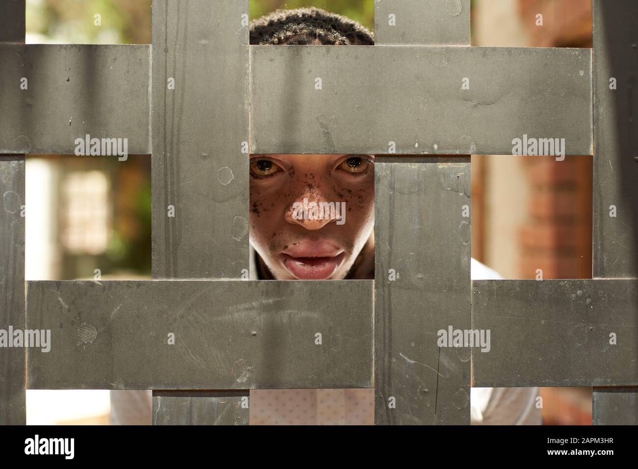 Porträt des jungen Mannes mit Vitiligo hinter Holzzaun Stockfoto