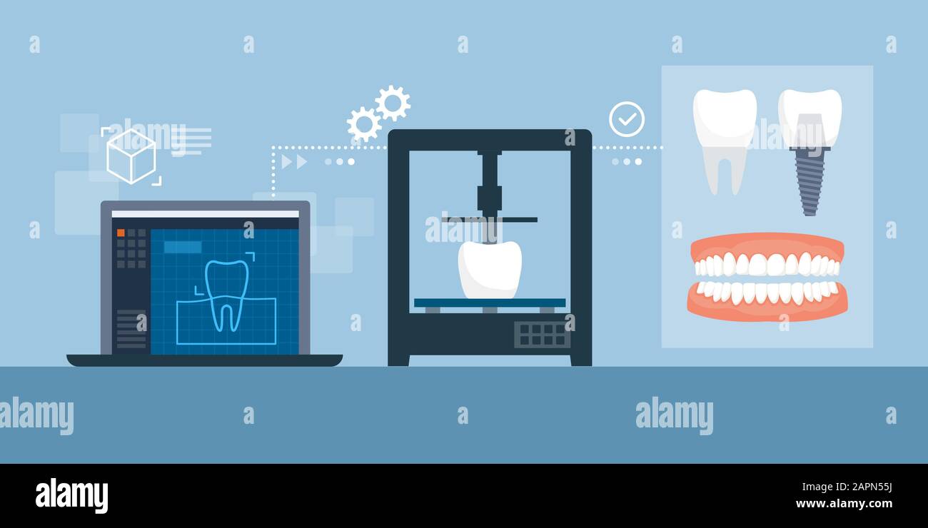 Medizinischer 3D-Druckprozess von Zahnprothese und Implantaten: 3D-Modellierung mit Software, Druck und Endprodukten Stock Vektor