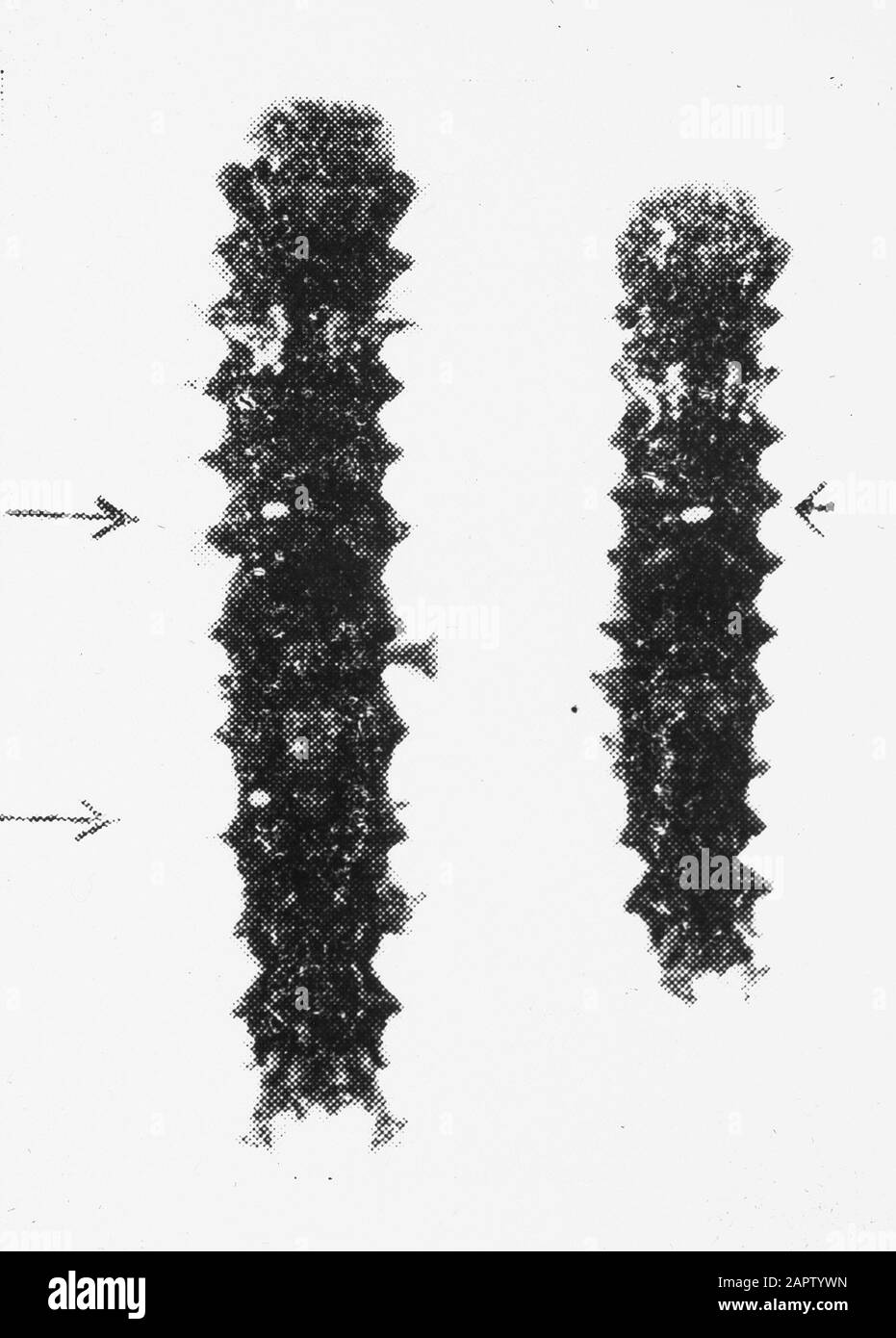 Insekten, Schäden, Parasitenfliege Datum: Undatierte Schlüsselwörter: Schadenersatz, Insekten Personenname: Parasitenfliege Stockfoto