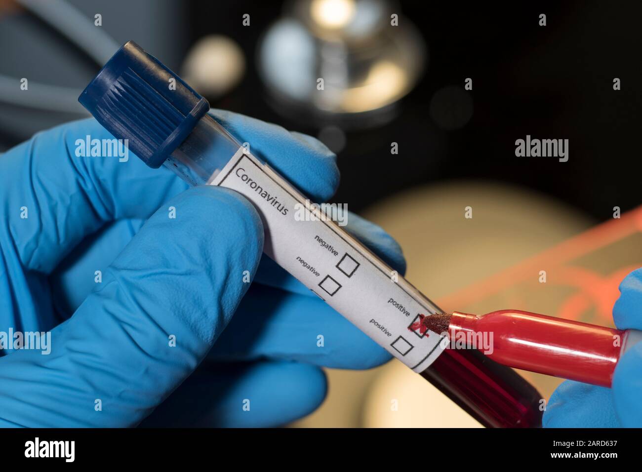 Bluttestflasche mit Coronavirus in der Hand eines medizinischen Arztes. Laborforschung, um die Ausbreitung des Wuhan Coronavirus zu finden und zu stoppen. Krankheitsausbruch du Stockfoto