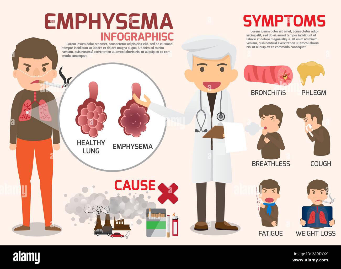 Chronische obstruktive Lungenerkrankung: COPD - Lungenemphysemerkrankung. Emphysem Infografikelemente: Vektorielle Gesundheitstickung und medizinisches Konzept Stock Vektor