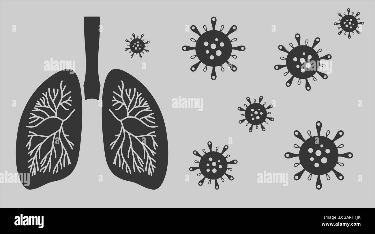 Das respiratorische Coronavirus im Nahen Osten greift die menschliche Lunge an Stockfoto