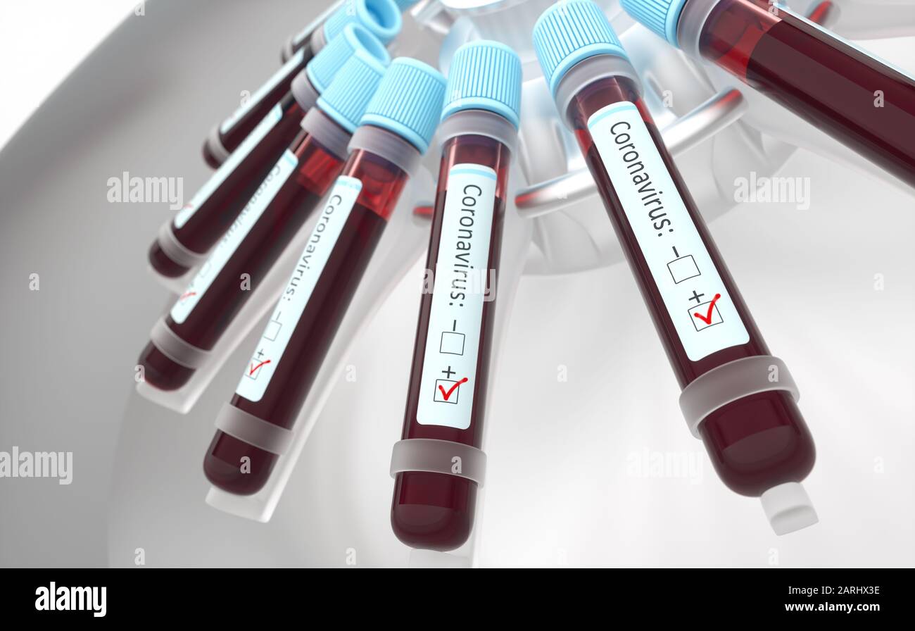 Coronaviren, eine Gruppe von Viren, die Krankheiten bei Säugetieren und Vögeln verursachen. Beim Menschen verursacht das Virus Atemwegsinfektionen. 3D-Abbildung. Stockfoto