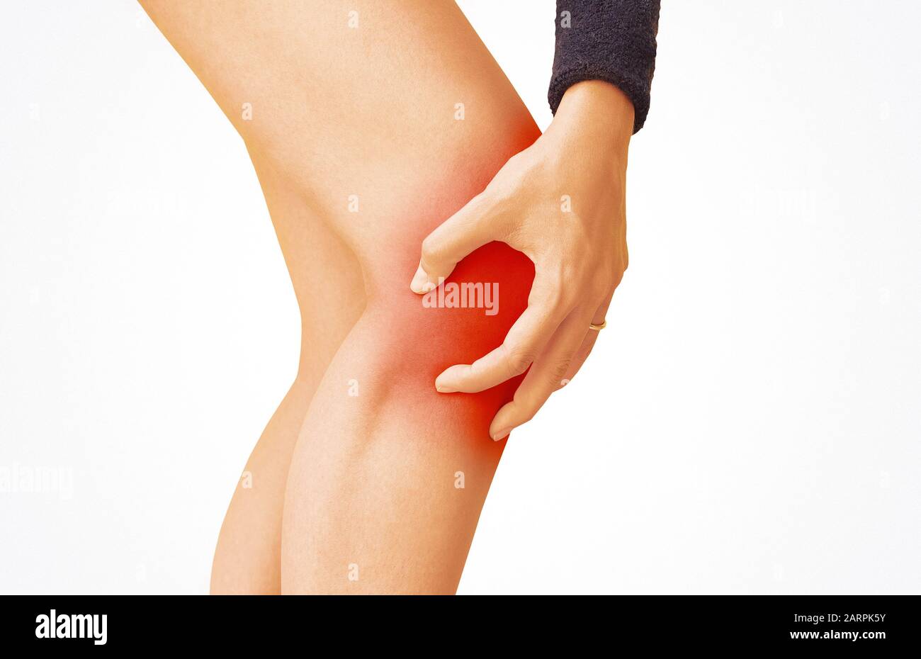 Akute Schmerzen im Knie einer Frau. Isolierung auf weißem Hintergrund Stockfoto