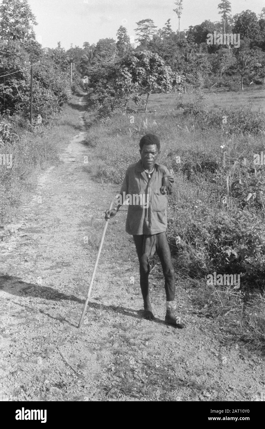 Neuguinea-Serie A papua mit Behinderung. Sein linker Arm ist stark verschmolzen Datum: Oktober 1948 Standort: Neuguinea Stockfoto