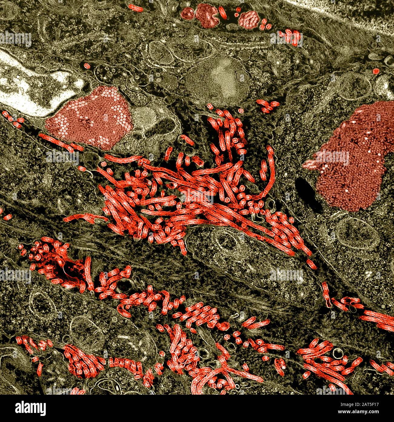 Ebola Virus on Cell. BOLA Virus Disease (EVD) ist eine tödliche Krankheit mit gelegentlichen Ausbrüchen, die vor allem auf dem afrikanischen Kontinent auftreten. Am häufigsten trifft die EVD auf Menschen und nichtmenschliche Primaten (wie Affen, Gorillas und Schimpansen). Sie wird durch eine Infektion mit einer Gruppe von Viren innerhalb der Gattung Ebolavirus verursacht: Ebolavirus (Spezies Zaire ebolavirus) Sudan-Virus (Species Sudan ebolavirus) Taï Waldvirus (Species Taï Forest ebolavirus, früher Côte d'Ivoire ebolavirus) Bundibugyo-Virus (Species Bundibugyo ebolavirus) Reston Virus Stockfoto