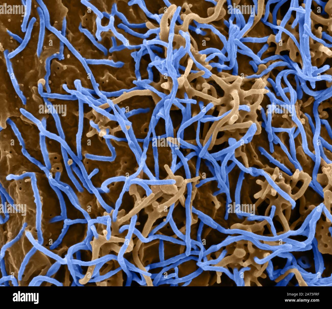 Ebola Virus on Cell. BOLA Virus Disease (EVD) ist eine tödliche Krankheit mit gelegentlichen Ausbrüchen, die vor allem auf dem afrikanischen Kontinent auftreten. Am häufigsten trifft die EVD auf Menschen und nichtmenschliche Primaten (wie Affen, Gorillas und Schimpansen). Sie wird durch eine Infektion mit einer Gruppe von Viren innerhalb der Gattung Ebolavirus verursacht: Ebolavirus (Spezies Zaire ebolavirus) Sudan-Virus (Species Sudan ebolavirus) Taï Waldvirus (Species Taï Forest ebolavirus, früher Côte d'Ivoire ebolavirus) Bundibugyo-Virus (Species Bundibugyo ebolavirus) Reston Virus Stockfoto