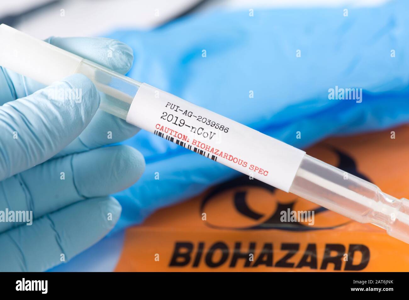 Corona-Virus 2019-nCoV Atemspritzprobe Tupfer Reagenzglas mit Handschuhen, Maske und Biohazard-Beutel. Stockfoto