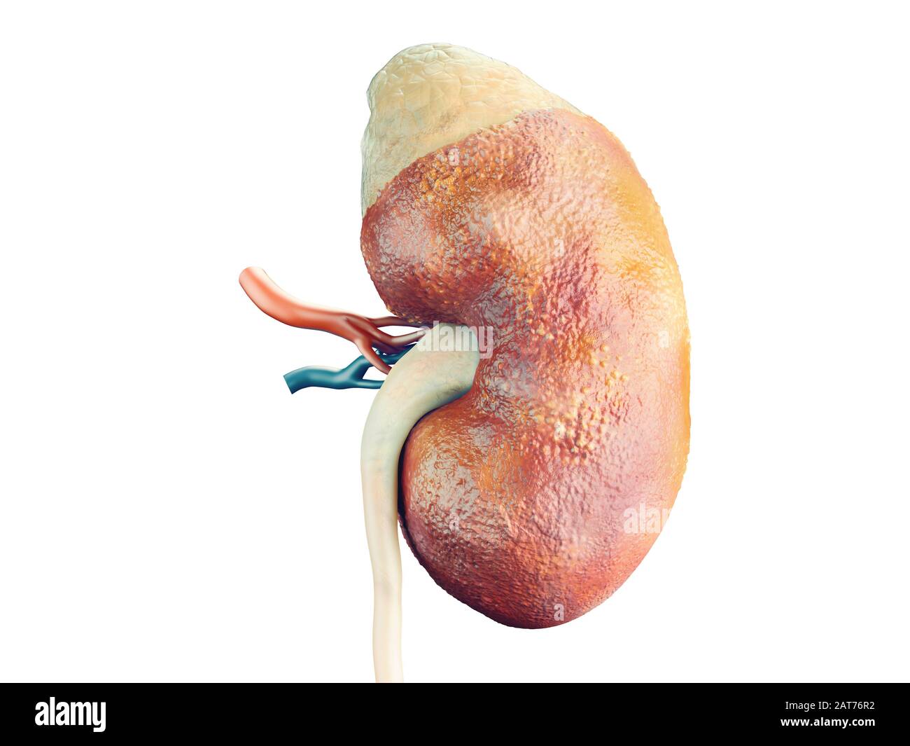 Fotorealistische 3D-Darstellung der Krankheit Krebs der menschlichen Niere mit Nebenniere und Gefäße isoliert auf weißem Stockfoto