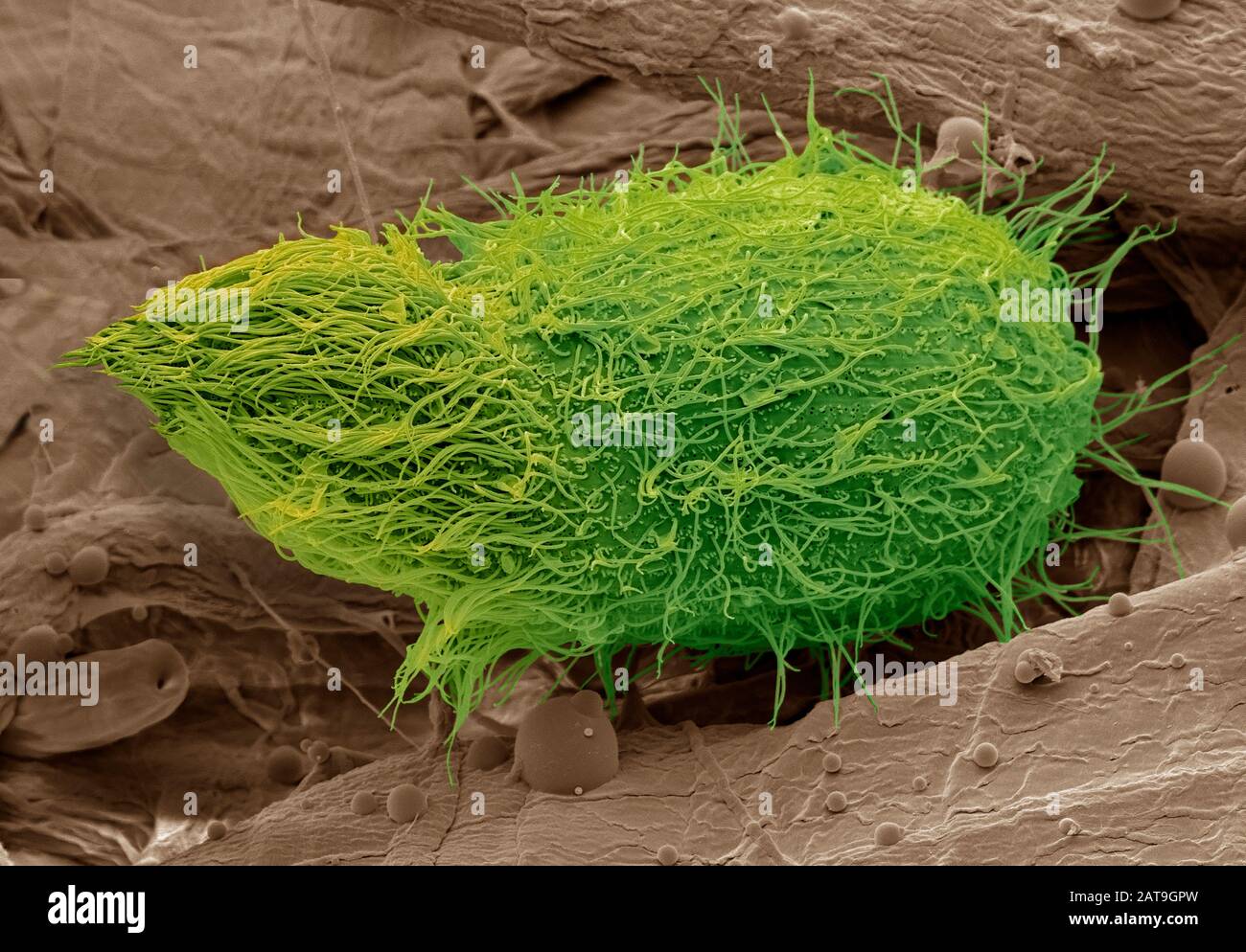 Loxophyllum ciliate protozoa, Sem Stockfoto