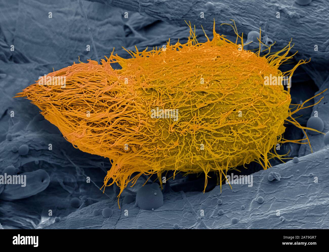 Loxophyllum ciliate protozoa, Sem Stockfotografie Alamy