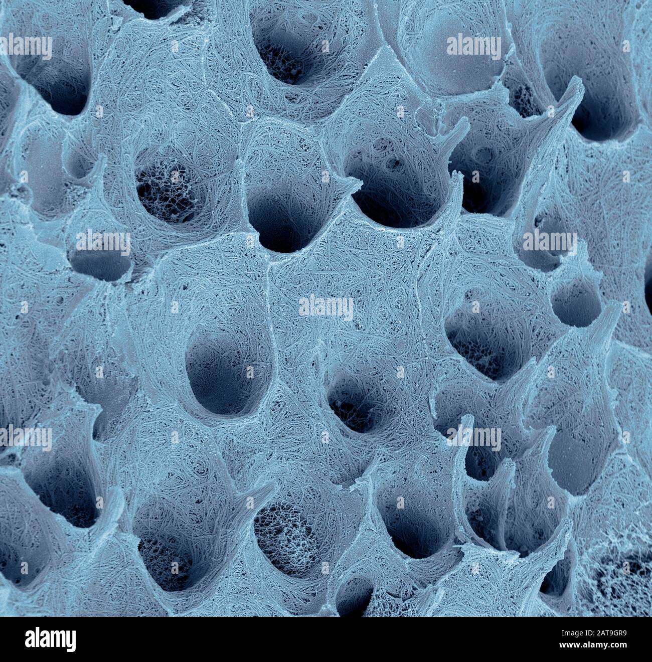 Zahndentin, Sem Stockfoto
