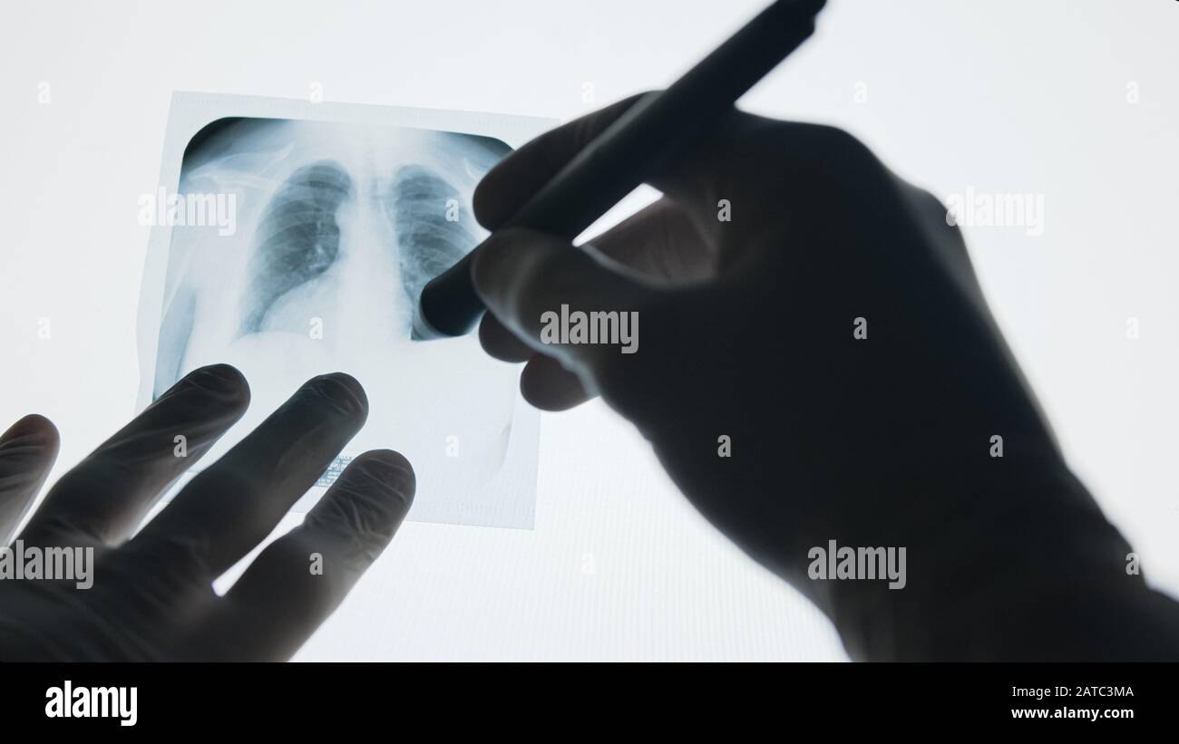 Arzt, der die Diagnose der Röntgensuche untersucht. Arzt zeigt mit einem Stift auf Röntgenbild. Medizinisches Konzept. Stockfoto