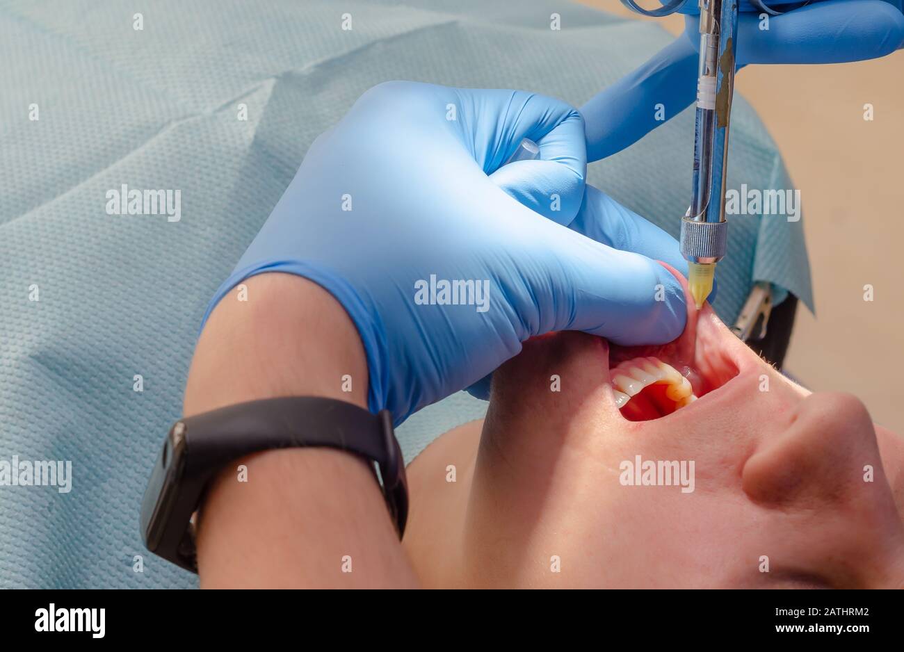 Der Arzt verabreicht dem Patienten in der Zahnklinik eine anästhetische Injektion Stockfoto