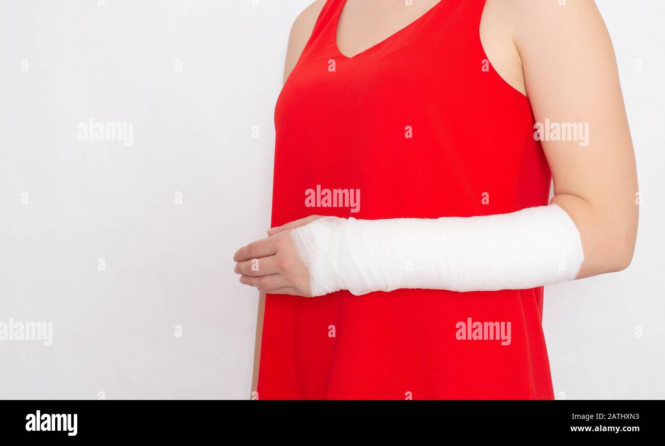 Mädchen in einem roten T-Shirt mit einem gebrochenen Arm in einem engen Verband und Putz auf weißem Grund. Radiales Frakturbehandlungskonzept, Kopierraum, Schmerzen Stockfoto